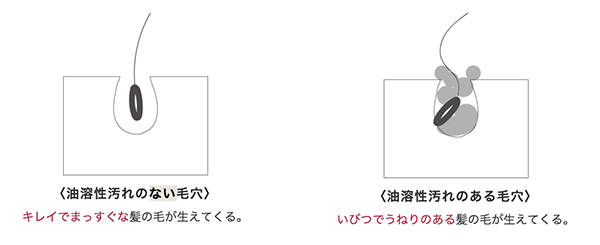 油溶性汚れのない毛穴とある毛穴についての図